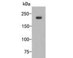 CNOT1 Polyclonal Antibody