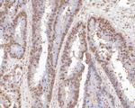 ONECUT3 Polyclonal Antibody