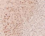 P-Glycoprotein Antibody in Immunohistochemistry (Paraffin) (IHC (P))