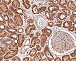 AP2A2 Antibody in Immunohistochemistry (Paraffin) (IHC (P))