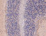 AP2A2 Polyclonal Antibody
