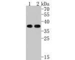 PHF11 Polyclonal Antibody