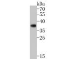PHF11 Antibody in Western Blot (WB)
