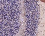 NARS Polyclonal Antibody