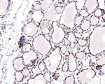 RAD52 Antibody in Immunohistochemistry (Paraffin) (IHC (P))