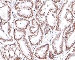 RAD52 Antibody in Immunohistochemistry (Paraffin) (IHC (P))