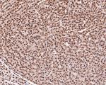 RAD52 Polyclonal Antibody