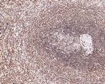 RAD52 Antibody in Immunohistochemistry (Paraffin) (IHC (P))