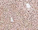 RAD52 Antibody in Immunohistochemistry (Paraffin) (IHC (P))