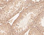 CDX4 Antibody in Immunohistochemistry (Paraffin) (IHC (P))