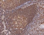 WASP Polyclonal Antibody