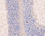 DACT1 Polyclonal Antibody