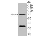 GNB4 Antibody in Western Blot (WB)