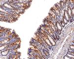 CIS Antibody in Immunohistochemistry (Paraffin) (IHC (P))
