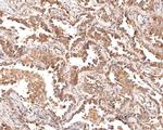 Cytokeratin 5/6 Polyclonal Antibody