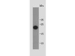 Shiga toxin 1B Polyclonal Antibody