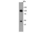 VEGFC Polyclonal Antibody