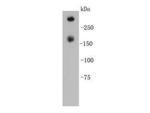 KLH Polyclonal Antibody