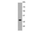 XBP1 Polyclonal Antibody