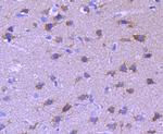 Tau Antibody in Immunohistochemistry (Paraffin) (IHC (P))