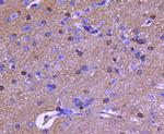 Tau Antibody in Immunohistochemistry (Paraffin) (IHC (P))