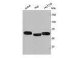 Lamin B2 Polyclonal Antibody