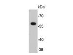 FokI Polyclonal Antibody