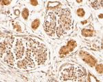 ID2 Antibody in Immunohistochemistry (Paraffin) (IHC (P))