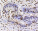Ku80 Antibody in Immunohistochemistry (Paraffin) (IHC (P))