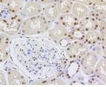 Ku80 Antibody in Immunohistochemistry (Paraffin) (IHC (P))