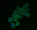 IFNAR1 Polyclonal Antibody