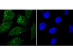 WDR5 Polyclonal Antibody
