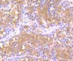 Ferritin Polyclonal Antibody