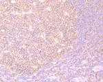 PKM2 Antibody in Immunohistochemistry (Paraffin) (IHC (P))