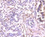 ALDH1A1 Antibody in Immunohistochemistry (Paraffin) (IHC (P))