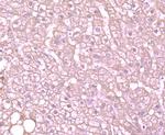 ALDH1A1 Antibody in Immunohistochemistry (Paraffin) (IHC (P))