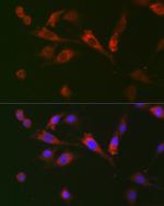 GDF15 Antibody in Immunocytochemistry (ICC/IF)