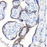 GDF15 Antibody in Immunohistochemistry (Paraffin) (IHC (P))