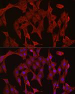 Caspase 3 Antibody in Immunocytochemistry (ICC/IF)