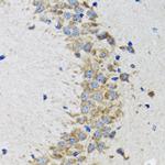 CDK1 Antibody in Immunohistochemistry (Paraffin) (IHC (P))