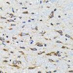 CDK1 Antibody in Immunohistochemistry (Paraffin) (IHC (P))