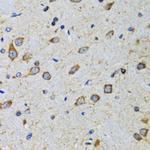 CDK1 Antibody in Immunohistochemistry (Paraffin) (IHC (P))