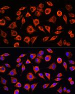 CRP Antibody in Immunocytochemistry (ICC/IF)