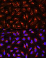 CRP Antibody in Immunocytochemistry (ICC/IF)