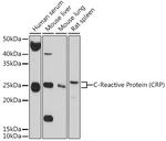 CRP Antibody in Western Blot (WB)