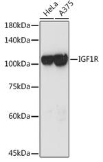 IGF1R (CD221) Polyclonal Antibody