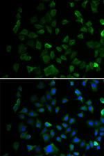 MEK1 Antibody in Immunocytochemistry (ICC/IF)