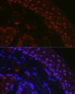 p73 Antibody in Immunohistochemistry (Paraffin) (IHC (P))