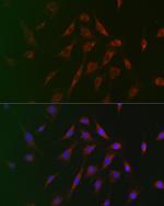 TSC2 Polyclonal Antibody