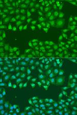 SSB Polyclonal Antibody